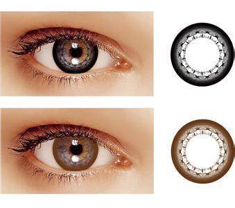 隱形眼鏡藏在眼球半年 忽視護(hù)理的可怕后果與美瞳使用的警示